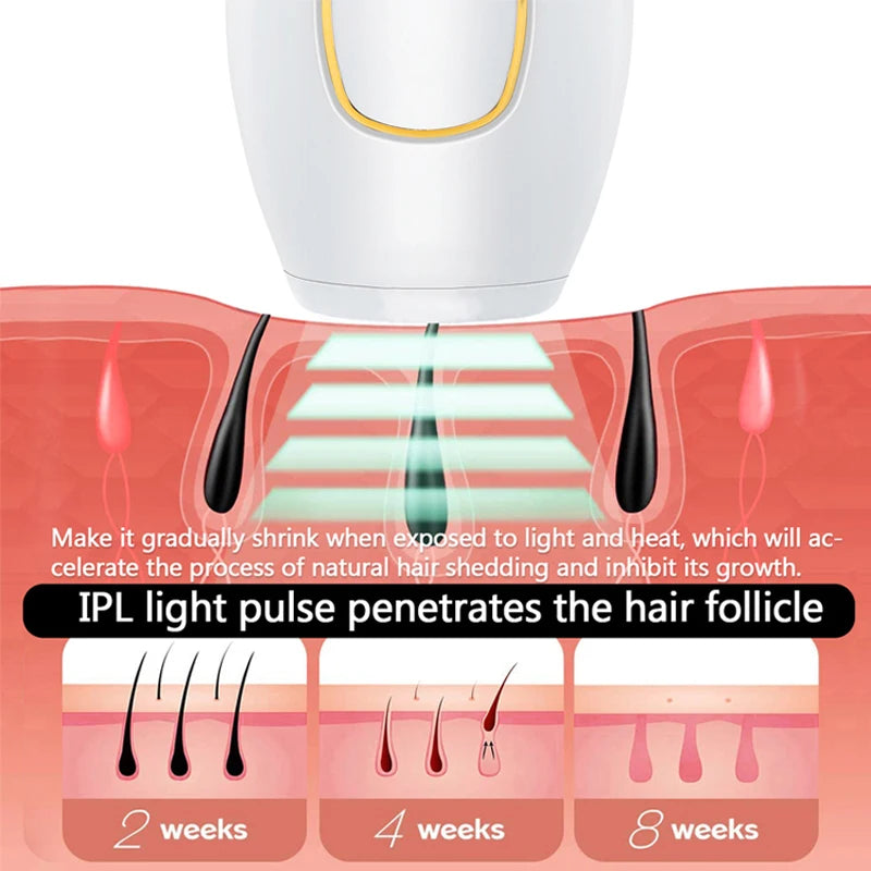 SmoothGlow™ Permanent Hair Removal Device Elura
